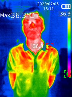 body -temp. measurement